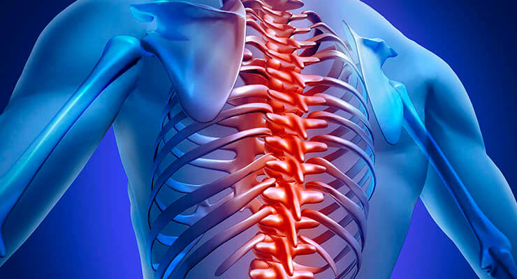 Опасность грудного хондроза Опасность грудного хондроза