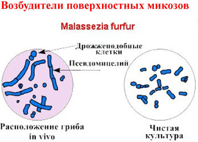 Возбудители микозов Возбудители микозов
