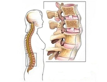 Нормальная анатомия