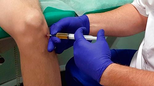 Инъекции внутрь сустава