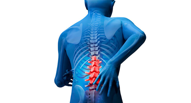 Травмы позвоночника Травмы позвоночника