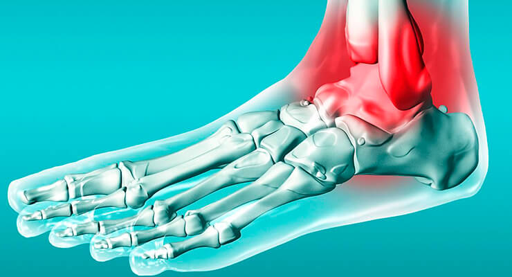 Голеностопный сустав: строение и основные механизмы работы