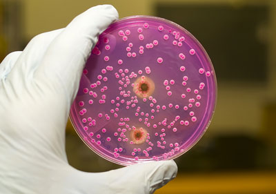 gribok-Candida Посев на грибок кандида