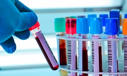 Болезнь Стилла у взрослых и детей – симптомы и лечение