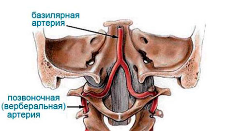 Что такое вертеброгенная компрессия позвоночных артерий