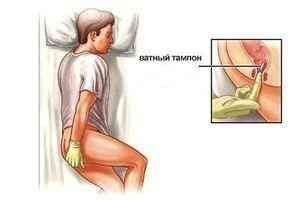 Чем полезно тыквенное масло при простатите?