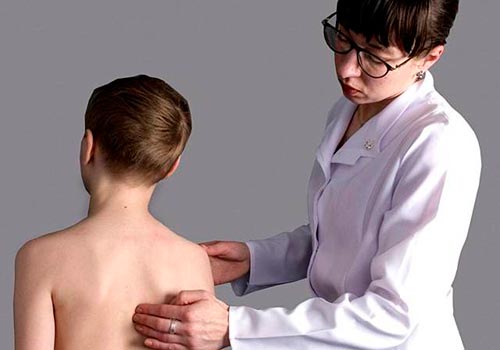 Диагностика нарушений осанки у ребенка