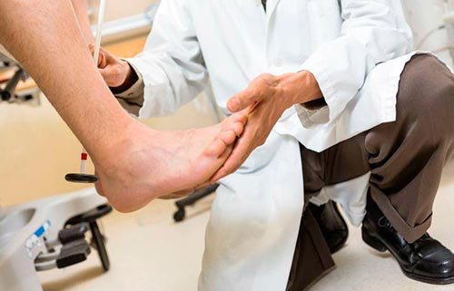 Что такое артроз стопы, его симптомы и лечение
