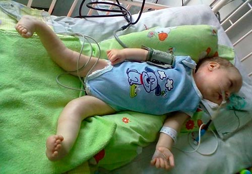 Возможные осложнения