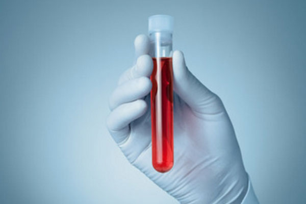 Рука в перчатке держит пробирку с кровью