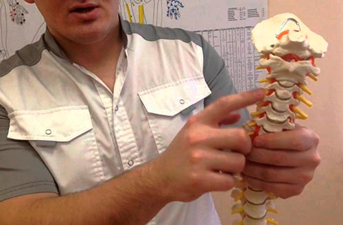 Аномалия Киммерли