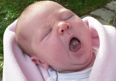 Белый налет на языке Белый налет на языке