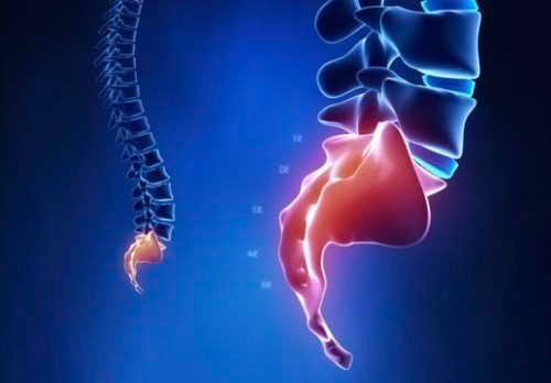 Симптомы смещения копчика