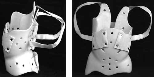 Вид бостонского корсета