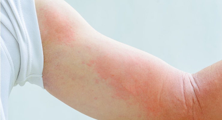 Список противопоказаний Список противопоказаний