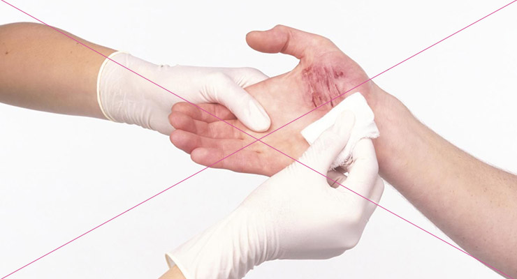 Противопоказания Противопоказания