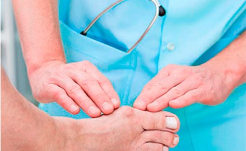 Лечение артрита ног