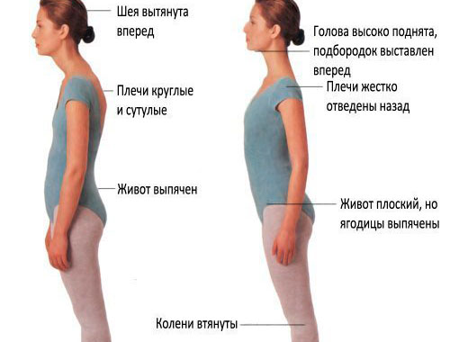 Не правильная и правильная осанка