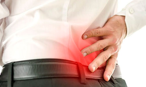 Что такое копчиковая грыжа?