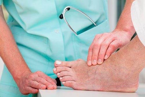 Артроз таранно-ладьевидного сустава