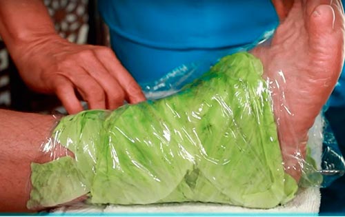 Артроз и артрит коленного сустава