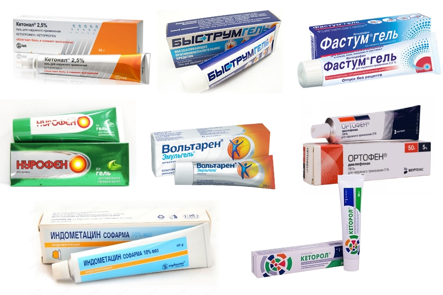 Мази от хондроза: использование, обзор препаратов