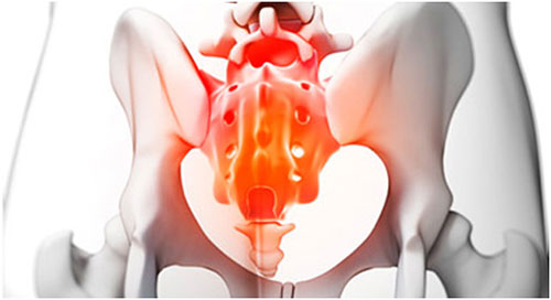 Лечение боли в крестце во время беременности