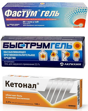 Мази от хондроза Мази от хондроза