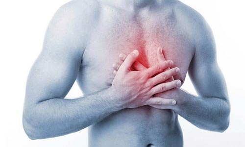 Лечение грудного радикулита