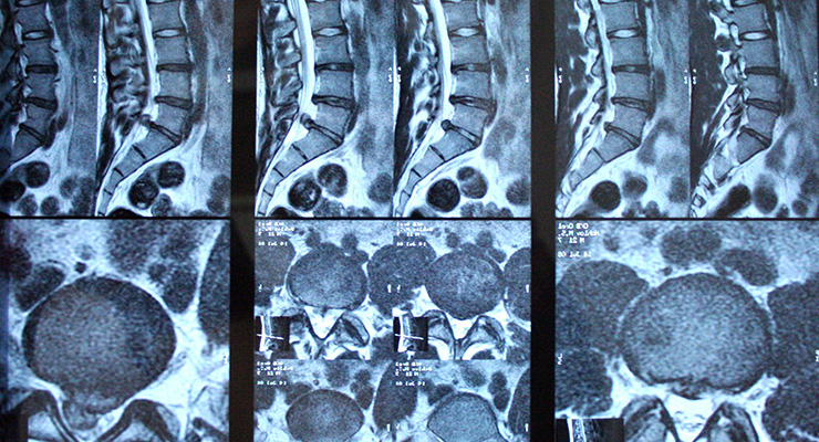 Стадии заболевания Стадии заболевания