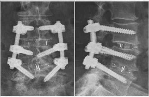 Хирургическое лечение