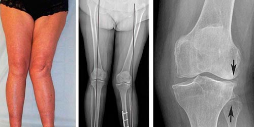 Функциональная диагностика