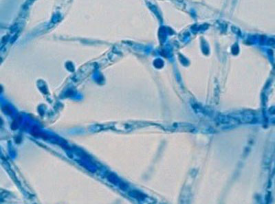 Trichophyton interdigitale под микроскопом Trichophyton interdigitale под микроскопом