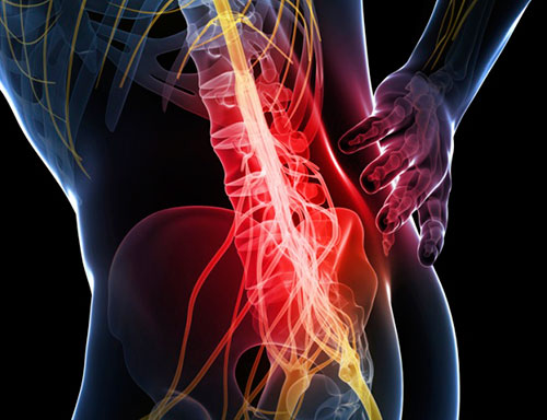 Симптомы болезней пояснично-крестцового отдела