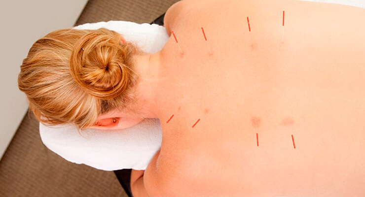 Другие методы терапии Другие методы терапии