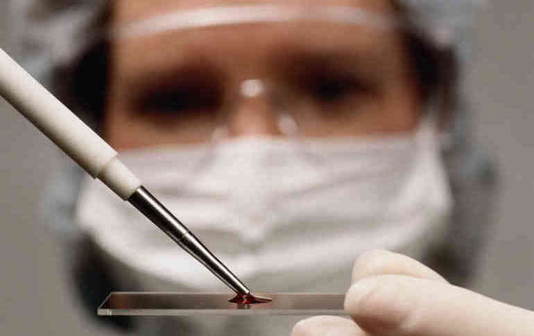 Какой оптимальный уровень ПСА после лучевой терапии рака простаты?