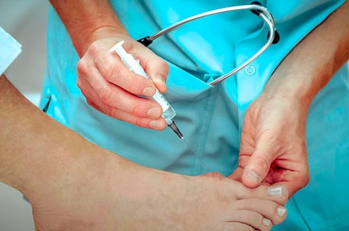 Причины, симптомы и лечение артрита суставов стопы