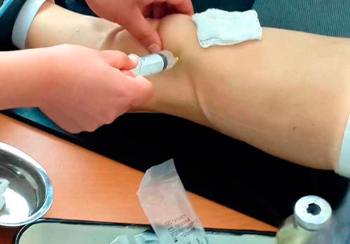 Анализ полости сустава