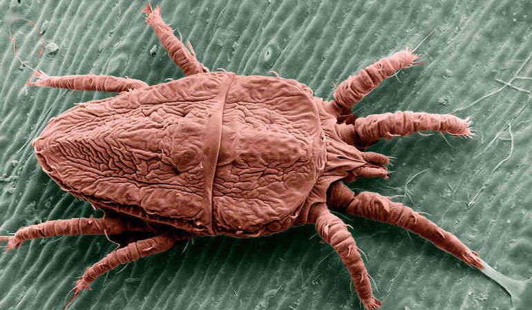 Чесотка и особенности ее протекания у мужчин