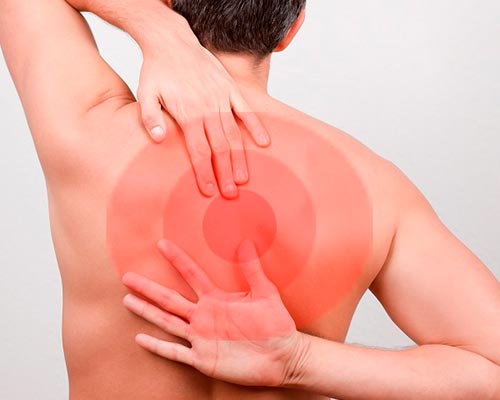 Причины возникновения грудного радикулита