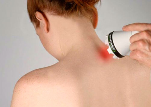 Физиотерапевтические процедуры при лечении спондилеза шейного отдела позвоночника