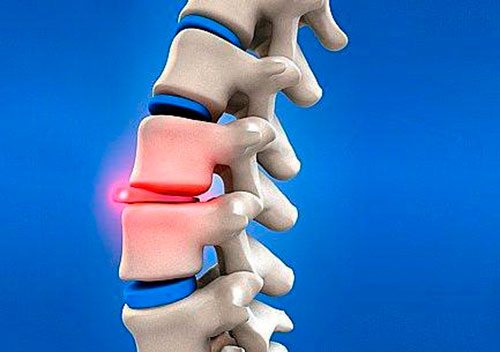 Причины развития болезней позвоночника