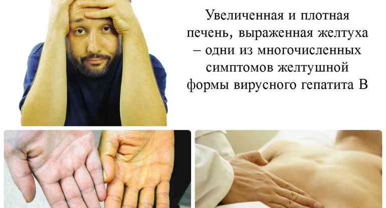 Все что нужно знать о гепатите Б!