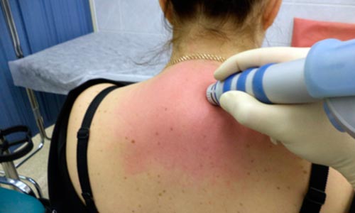 Почему растет горб на спине и как его убрать?