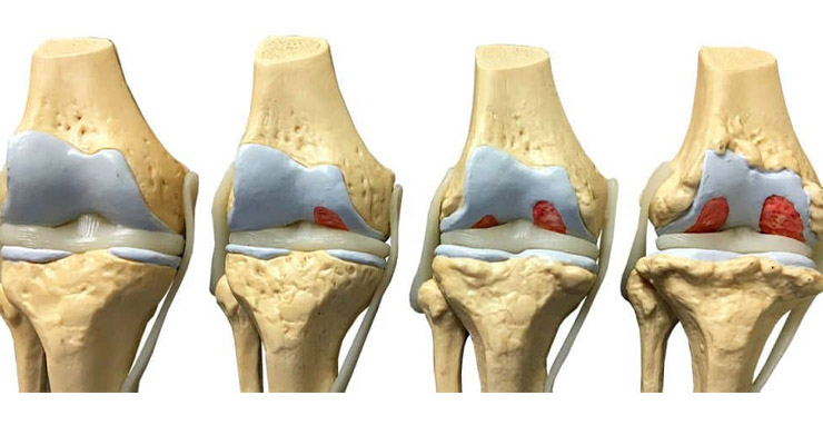 Показания к применению Показания к применению