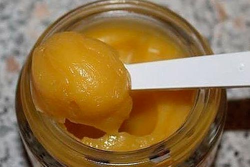 Блуждающий артрит