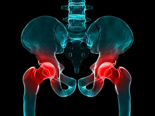 Боль переходящая в тазобедренный сустав