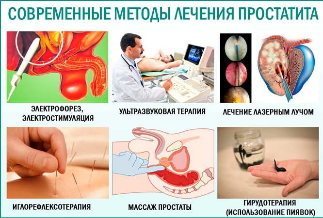 Современные методы лечения простатита