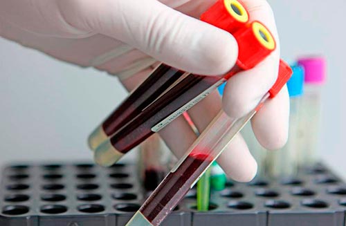 Анализ крови