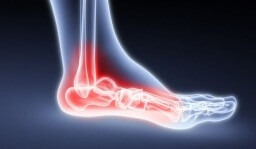 проблемы стопы